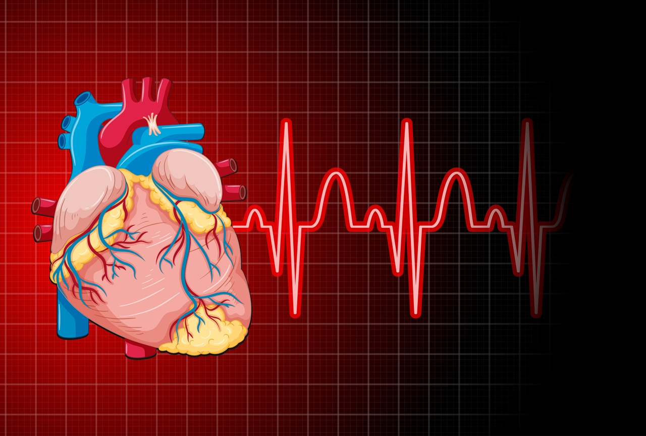 Stroke, szívinfarktus: hogyan előzzük meg?